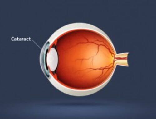 Small Incision Cataract Surgery